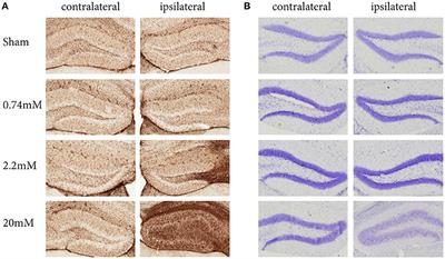 A Standardized Protocol for Stereotaxic Intrahippocampal Administration of Kainic Acid Combined with Electroencephalographic Seizure Monitoring in Mice